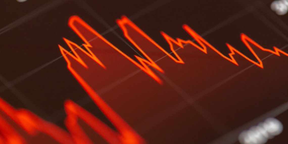 Κατακόρυφη πτώση μετοχών στις αυτοκινητοβιομηχανίες έφεραν οι νέοι δασμοί Τραμπ